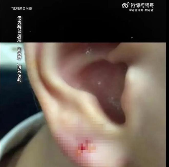 假率超过75%很多人天天用孩子也爱戴开元棋牌app致癌物超标1179倍造(图6)